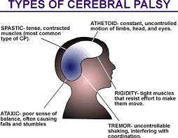 Cerebral Palsy2