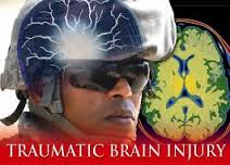 soldiers and TBI